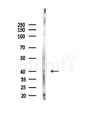 MYLK4 Antibody - Western blot analysis of lysates from A375 cells(heat-shock, 45min treatment), using MYLK4 Antibody at 1/1000 dilution.