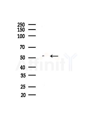 MYOT Antibody - Western blot analysis of lysates from A375 cells(heat-shock, 45min treatment), using MYOT Antibody at 1/1000 dilution.