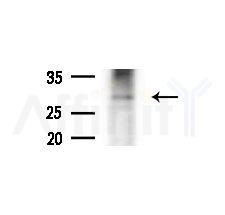 Myozenin2 Antibody - Western blot analysis of extracts from A375 cells(heat-shock,45min treatment), using Myozenin2 Antibody at 1/1000 dilution.