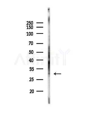 Myozenin2 Antibody - Western blot analysis of lysates from A375 cells(heat-shock,45min treatment), using Myozenin2 Antibody at 1/1000 dilution.