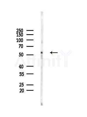 NAP1L4 Antibody - Western blot analysis of lysates from HepG2 cells(starvation treatment), using NAP1L4 Antibody at 1/1000 dilution.