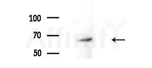 NCOA5 Antibody - Western blot analysis of extracts from A375 cells(heat-shock treatment), using NCOA5 Antibody at 1/1000 dilution.