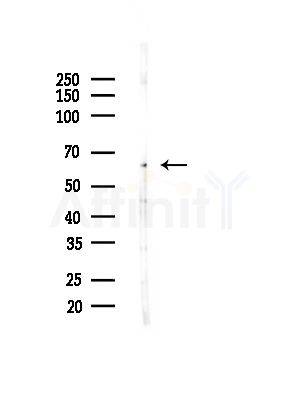 NCOA5 Antibody - Western blot analysis of lysates from A375 cells(heat-shock, 45min treatment), using NCOA5 Antibody at 1/1000 dilution.