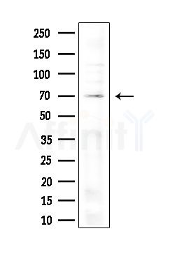 NDOR1 Antibody - Western blot analysis of extracts from Hela cells(heat-shock,45min treatment), using NDOR1 Antibody at 1/1000 dilution.