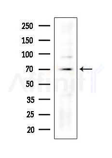 NDOR1 Antibody - Western blot analysis of extracts from A375 cells(heat-shock,45min treatment), using NDOR1 Antibody at 1/1000 dilution.