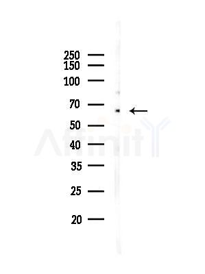 NDOR1 Antibody - Western blot analysis of lysates from A375 cells(heat-shock,45min treatment), using NDOR1 Antibody at 1/1000 dilution.
