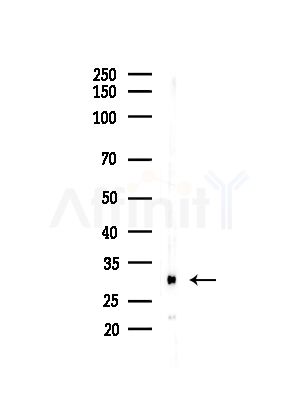 NDUFAF2 Antibody - Western blot analysis of lysates from Hela cells(heat-shock,45min treatment), using NDUFAF2 Antibody at 1/1000 dilution.