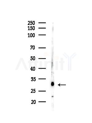NDUFAF2 Antibody - Western blot analysis of lysates from MCF7 cells(heat-shock,45min treatment), using NDUFAF2 Antibody at 1/1000 dilution.