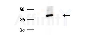NECAP1 Antibody - Western blot analysis of extracts from COLO205 cells(heat-shock treatment), using NECAP1 Antibody at 1/1000 dilution.