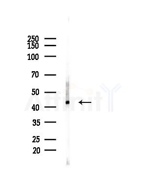 NECAP1 Antibody - Western blot analysis of lysates from COLO205 cells(heat-shock, 45min treatment), using NECAP1 Antibody at 1/1000 dilution.
