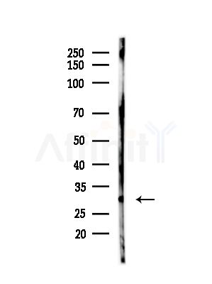 NME5 Antibody - Western blot analysis of lysates from Hela cells(heat-shock,45min treatment), using NME5 Antibody at 1/1000 dilution.
