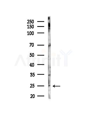 NME5 Antibody - Western blot analysis of lysates from MCF7 cells(heat-shock,45min treatment), using NME5 Antibody at 1/1000 dilution.