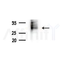 NMRAL1 Antibody - Western blot analysis of extracts from Mouse liver, using NMRAL1 Antibody at 1/1000 dilution.