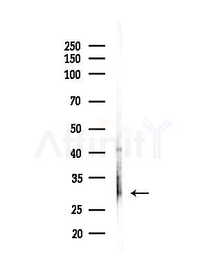 NMRAL1 Antibody - Western blot analysis of lysates from Mouse liver, using NMRAL1 Antibody at 1/1000 dilution.