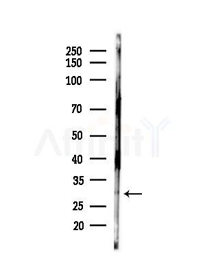 NNMT Antibody - Western blot analysis of lysates from Hela cells(heat-shock,45min treatment), using NNMT Antibody at 1/1000 dilution.
