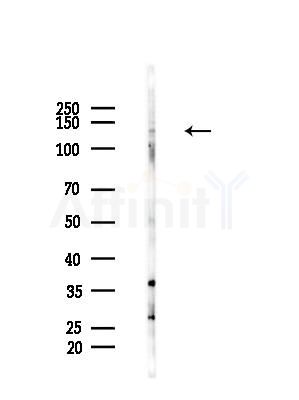 NOMO2 Antibody - Western blot analysis of lysates from B16F10-HUC(heat-shock treatment), using NOMO2 Antibody at 1/1000 dilution.