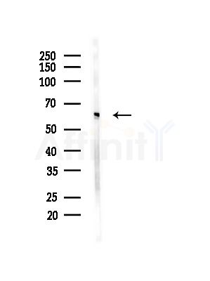 NOP58 Antibody - Western blot analysis of lysates from Mouse liver, using NOP58 Antibody at 1/1000 dilution.