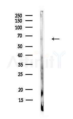 NPLOC4 Antibody - Western blot analysis of lysates from Rat liver, using NPLOC4 Antibody at 1/1000 dilution.