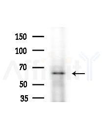nucleobindin1 Antibody - Western blot analysis of extracts from Hela cells(heat-shock,45min treatment), using nucleobindin1 Antibody at 1/1000 dilution.