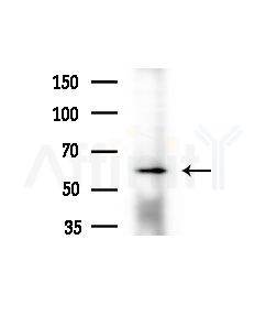nucleobindin1 Antibody - Western blot analysis of extracts from A375 cells(heat-shock,45min treatment), using nucleobindin1 Antibody at 1/1000 dilution.