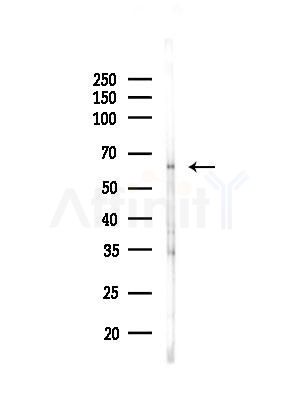 nucleobindin1 Antibody - Western blot analysis of lysates from Hela cells(heat-shock,45min treatment), using nucleobindin1 Antibody at 1/1000 dilution.