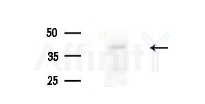 NUDT9 Antibody - Western blot analysis of extracts from A375 cells(heat-shock treatment), using NUDT9 Antibody at 1/1000 dilution.