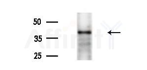 NUDT9 Antibody - Western blot analysis of extracts from Mouse liver, using NUDT9 Antibody at 1/1000 dilution.