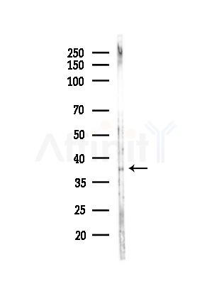 OCIAD1 Antibody - Western blot analysis of lysates from MCF7 cells(heat-shock,45min treatment), using OCIAD1 Antibody at 1/1000 dilution.