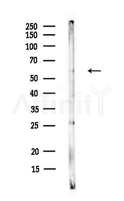 ODF2L Antibody - Western blot analysis of lysates from Rat liver, using ODF2L Antibody at 1/1000 dilution.
