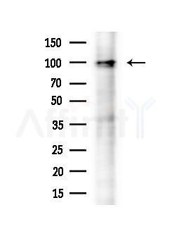 OGDHL Antibody - Western blot analysis of extracts from Rat brain, using OGDHL Antibody at 1/1000 dilution.