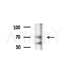 OSBPL10 Antibody - Western blot analysis of extracts from A375 cells(heat-shock,45min treatment), using OSBPL10 Antibody at 1/1000 dilution.