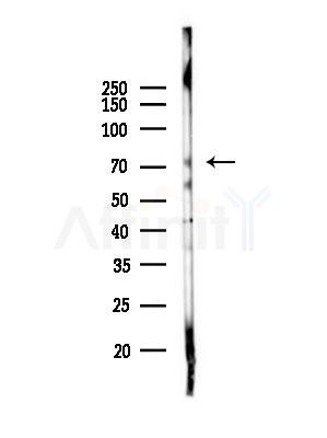OSBPL10 Antibody - Western blot analysis of lysates from A375 cells(heat-shock,45min treatment), using OSBPL10 Antibody at 1/1000 dilution.