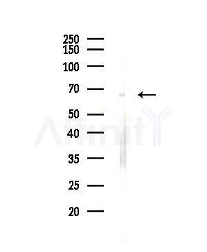Collagen X Antibody - Western blot analysis of lysates from Hela cells(starvation,24h treatment), using Collagen X Antibody at 1/1000 dilution.