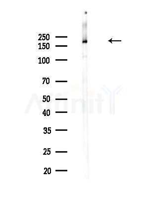 Clathrin Antibody - Western blot analysis of lysates from PC12 cells(heat-shock,45min treatment), using Clathrin Antibody at 1/1000 dilution.