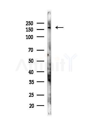 C3 Antibody - Western blot analysis of lysates from Hela cells(heat-shock,45min treatment), using C3 Antibody at 1/1000 dilution.