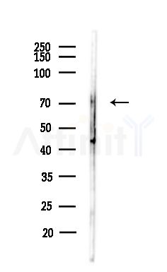 Prolyl Endopeptidase Antibody - Western blot analysis of lysates from MCF7 cells(heat-shock,45min treatment), using Prolyl Endopeptidase Antibody at 1/1000 dilution.