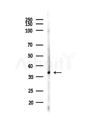 Stra8 Antibody - Western blot analysis of lysates from PC12 cells(LPS,4h treatment), using Stra8 Antibody at 1/1000 dilution.