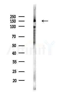 Tenascin-N Antibody - Western blot analysis of lysates from B16F10-LUC cells(heat-shock,45min treatment), using Tenascin-N Antibody at 1/1000 dilution.