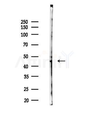 Brachyury / Bry Antibody - Western blot analysis of lysates from Hela cells(UV,30 min treatment), using Brachyury / Bry Antibody at 1/1000 dilution.
