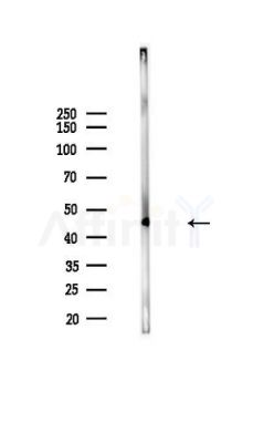 Brachyury / Bry Antibody - Western blot analysis of lysates from Mouse lung, using Brachyury / Bry Antibody at 1/1000 dilution.