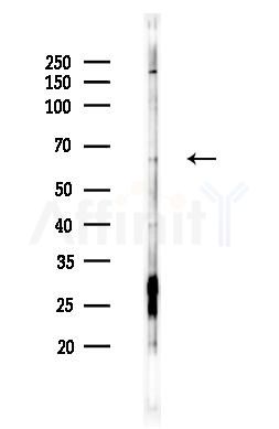 KCNC2 Antibody - Western blot analysis of lysates from RAW264.