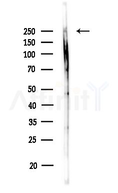 Nav1.8 Antibody - Western blot analysis of lysates from Rat brain, using Nav1.