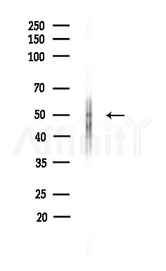 Nicotinic Acetylcholine Receptor alpha 7 Antibody - Western blot analysis of lysates from Hela cells(heat-shock,45min treatment), using Nicotinic Acetylcholine Receptor alpha 7 Antibody at 1/1000 dilution.