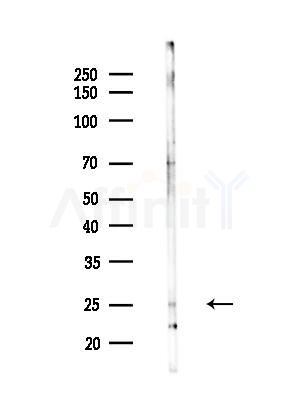 Dectin-1 Antibody - Western blot analysis of lysates from Mouse liver, using Dectin-1 Antibody at 1/1000 dilution.