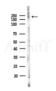 MDC1 Antibody - Western blot analysis of lysates from HepG2 cells(heat-shock,45min treatment), using MDC1 Antibody at 1/1000 dilution.