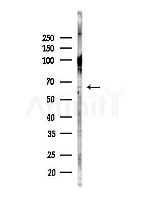 CENPB Antibody - Western blot analysis of lysates from Hela cells(heat-shock,45min treatment), using CENPB Antibody at 1/1000 dilution.