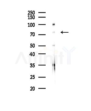 LAP2 alpha Antibody - Western blot analysis of lysates from Hela cells(starvation,24h treatment), using LAP2 alpha Antibody at 1/1000 dilution.