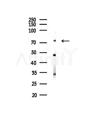 LAP2 alpha Antibody - Western blot analysis of lysates from HUVEC cells(UV,30min treatment), using LAP2 alpha Antibody at 1/1000 dilution.