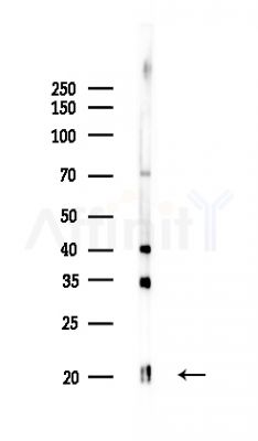 Casein Antibody - Western blot analysis of lysates from Rat brain, using Casein Antibody at 1/1000 dilution.