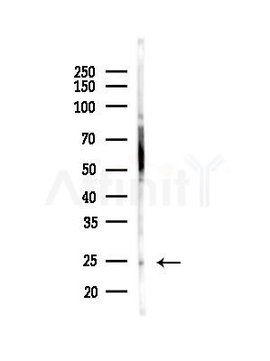 RBPMS Antibody - Western blot analysis of lysates from HUVEC cells(starvation,24h treatment), using RBPMS Antibody at 1/1000 dilution.
